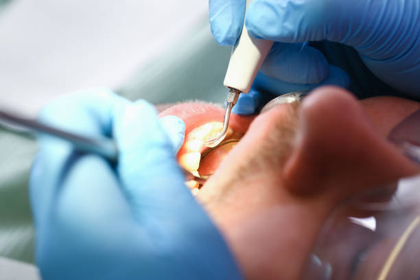 Best Emergency Gum Pain Relief  in Encantada Ranchito El Calaboz, TX