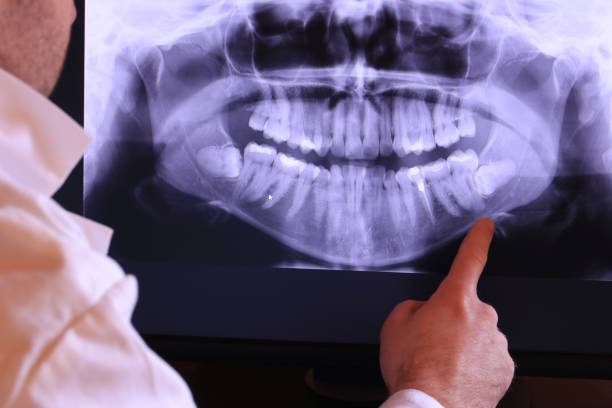 Best Emergency Dental Filling Replacement  in Encantada Ranchito El Calaboz, TX